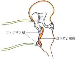 手術方法